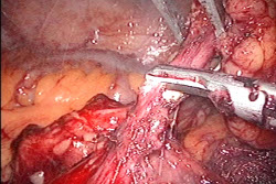 Sezione arteria mesenterica